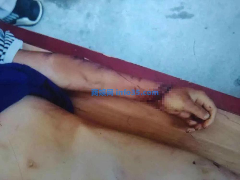 被父母虐待致死的12岁男孩:多次逃跑流浪,临死前被吊在太阳直射的三楼