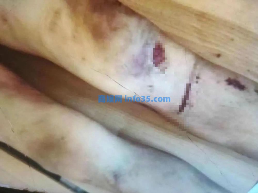 被父母虐待致死的12岁男孩:多次逃跑流浪,临死前被吊在太阳直射的三楼