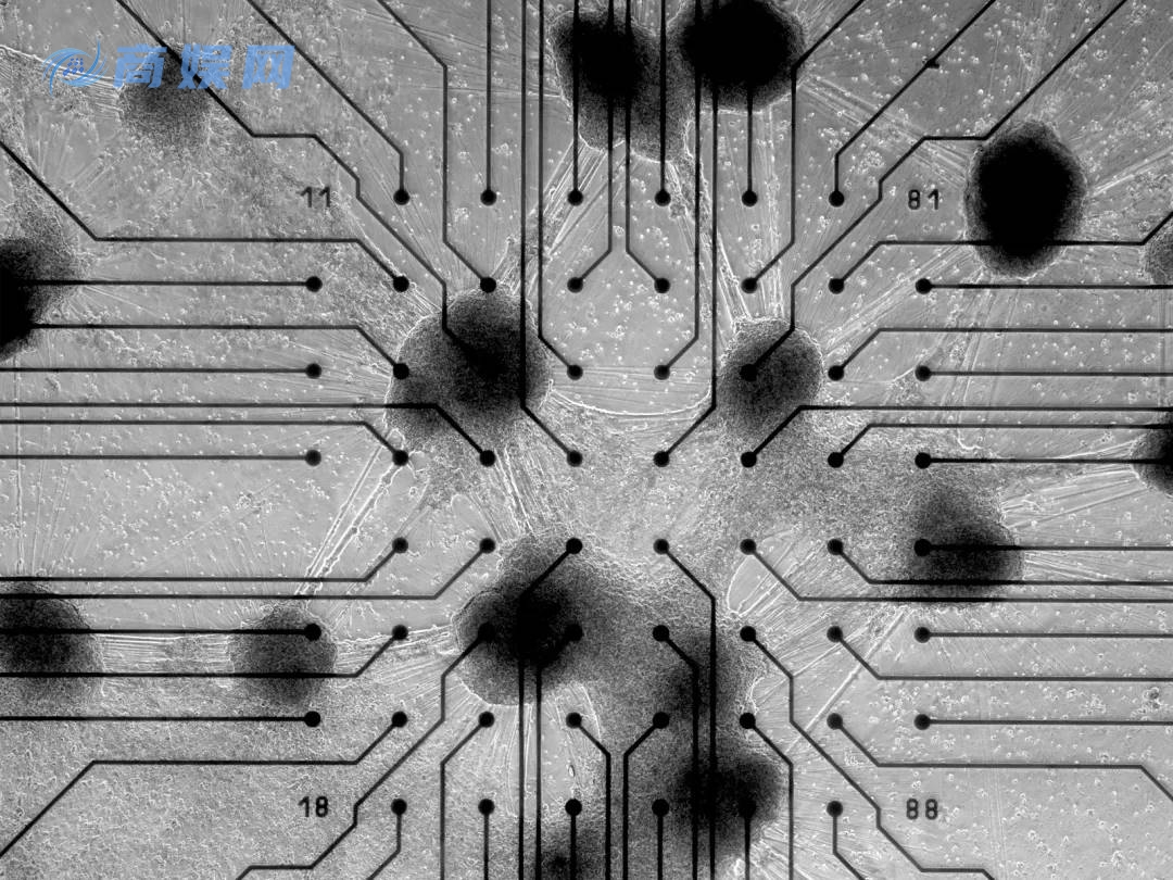 20 万一台的「人脑计算机」,可能是人类战胜 AI 的唯一方式?