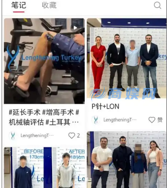 “断骨增高术”国内死灰复燃 专家警告风险依然巨大